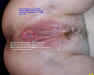 finger10.jpg (77266 bytes)
